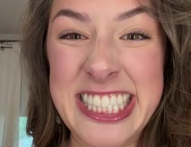 Your smile